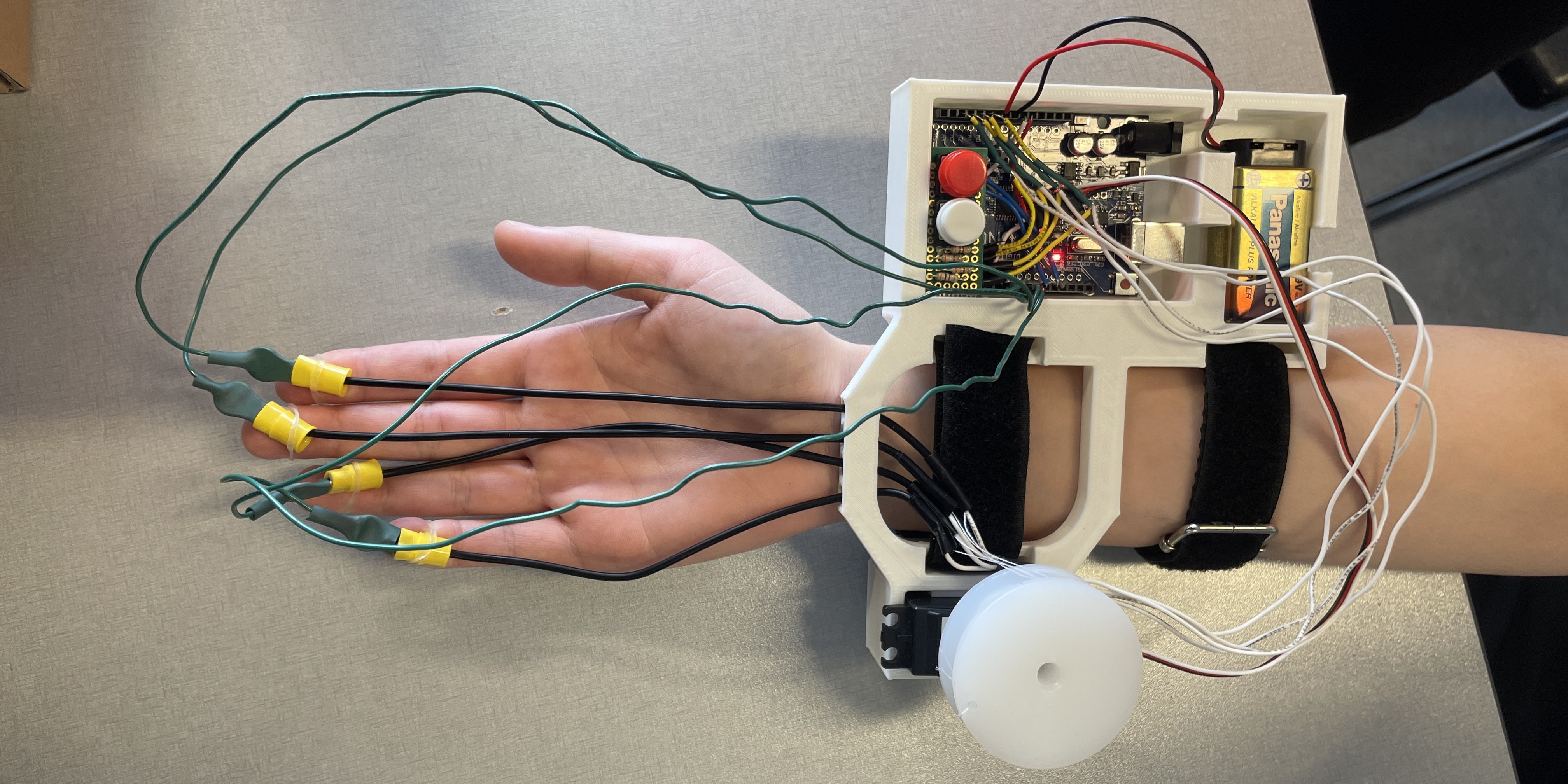 Hand Rehabilitation Device project